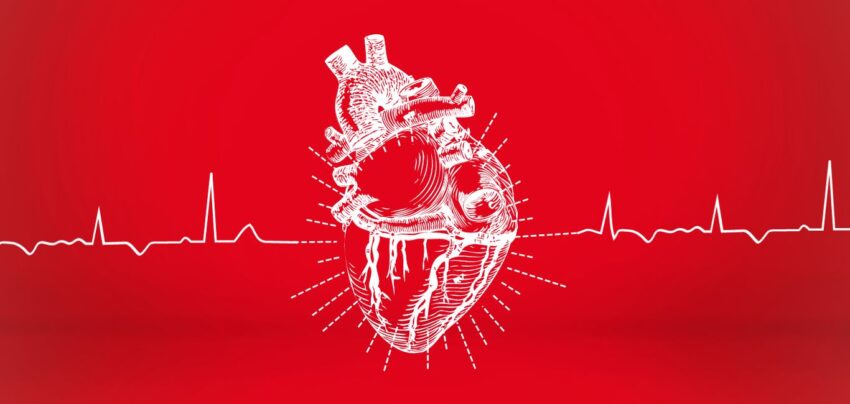Human Immune Response to Heart Attacks